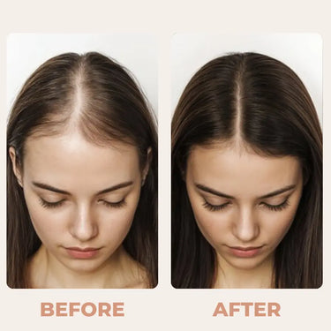Thinning Crown